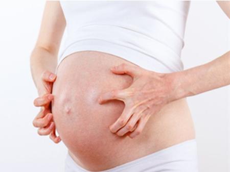 準(zhǔn)媽媽皮膚瘙癢，可適當(dāng)用藥！